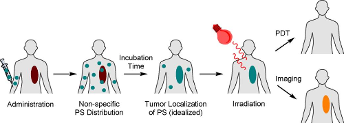 图1 Clinical development of metal complexes as photosensitizers for photodynamic therapy of cancer.<sup>[1]</sup>