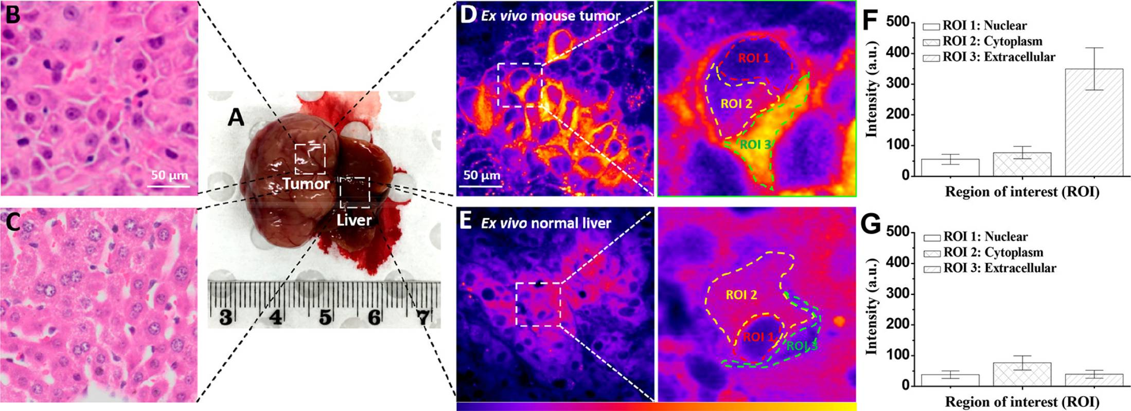 图2 (A) Macropathological images of resected mouse liver bearing a tumor. H&E histopathological images of fixed biopsies of tumor (B) and normal liver tissue (C), respectively. Confocal fluorescence images of a section of ex vivo mouse tumor (D) and normal liver tissue (E), stained with PHX2 (15 μM) for 15 min. Average fluorescence intensity of the nuclear, cytoplasm, and extracellular regions of tumor (F) and normal tissue (G)<sup> [1] </sup>.
